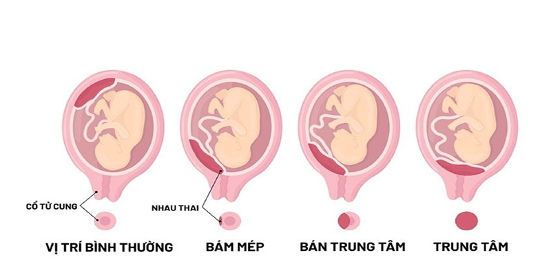vi-tri-cua-nhau-tien-dao